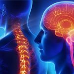 ¿Qué es la fisioterapia neurológica?