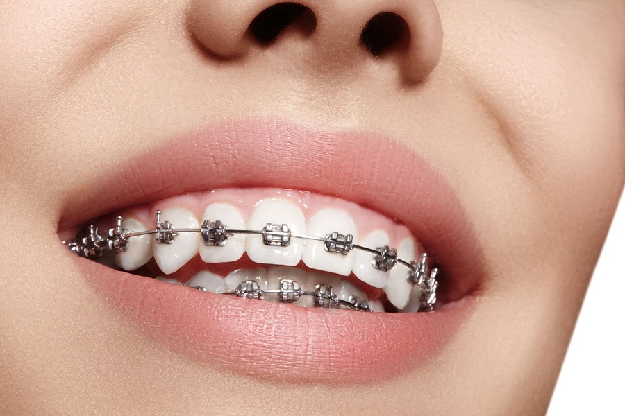 Especialidades odontológicas - cirujano dentista